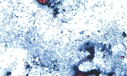 Parasite provoquant la diarrhée | Les autorités fédérales ne s’inquiètent pas de l’importation d’aliments