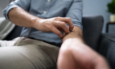 Démystifier la science | Quand les démangeaisons piquent la curiosité
