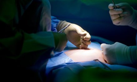 Proposition de la CAQ | Médecins au public et privé : la FMSQ pour, la CSN contre