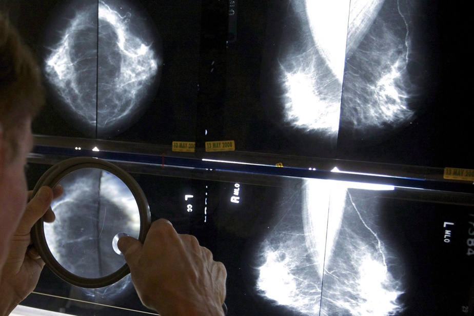 Cancer du sein | Pas de dépistage systématique pour les 45 à 49 ans malgré une recommandation de l’INESSS